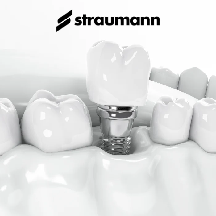 Straumann implants. A patient’s guide.